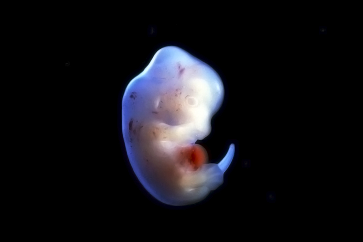 Ученые создали первый искусственный эмбрион человека из стволовых клеток