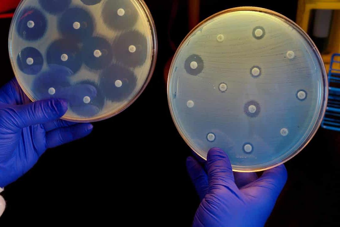 Медицина будущего: ИИ всего за несколько часов нашел самый мощный антибиотик  