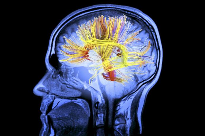 Ученые доказали – мозгу нужно больше усилий, чтобы забыть, а не запомнить