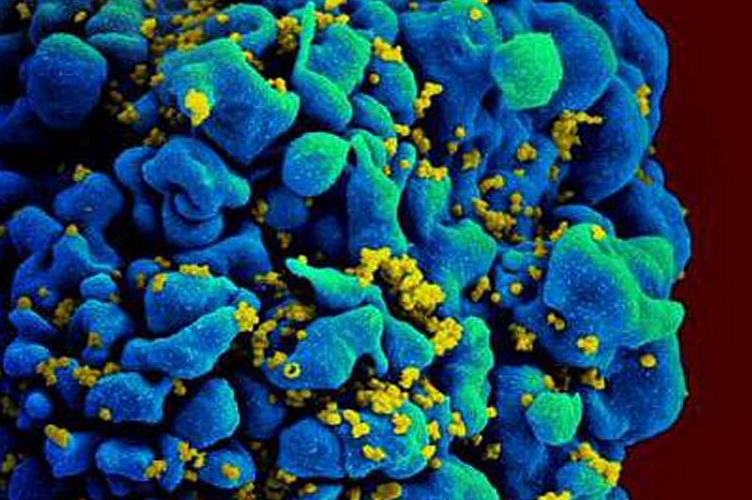 Очередной пациент избавился от ВИЧ с помощью стволовых клеток