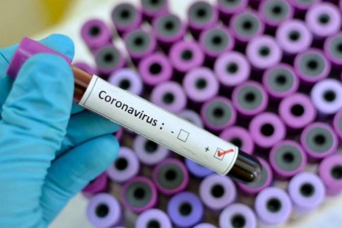 В Армении зафиксирован первый случай нового коронавируса։ премьер-министр призывает всех сохранять спокойствие