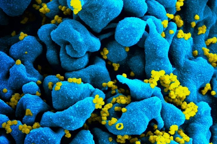 Медицина будущего: ученые нашли способ уничтожить скрытые резервы ВИЧ