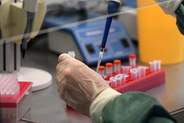 Роспотребнадзор создал высокоточный тест на коронавирус