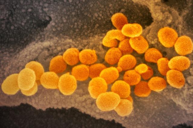 Новое исследование: коронавирус наиболее заразен в первую неделю