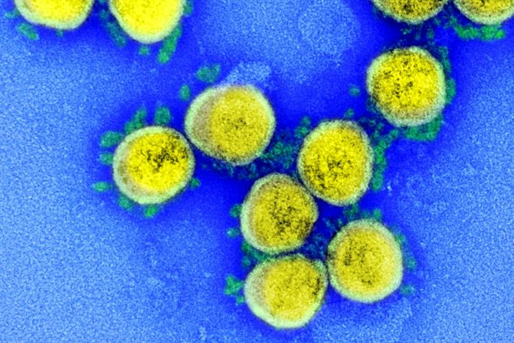 Микробиологи: вызвавший пандемию коронавирус SARS-CoV-2 является результатом естественного отбора, а не продуктом генной инженерии