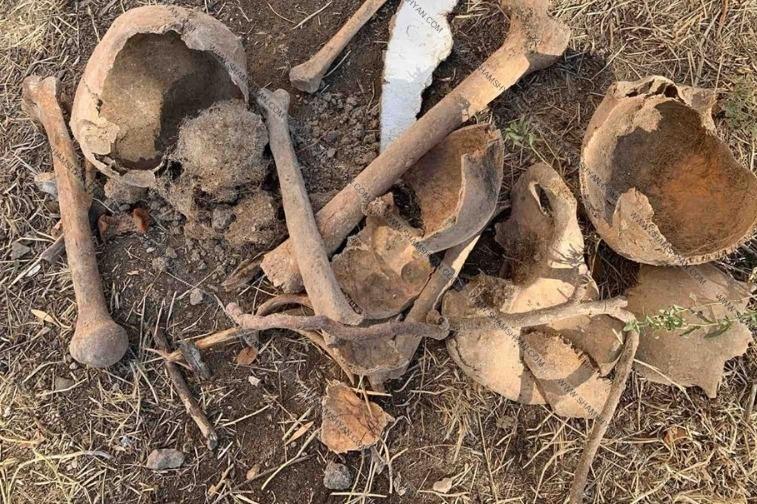 В ходе ремонтных работ в ереванской больнице обнаружены человеческие кости