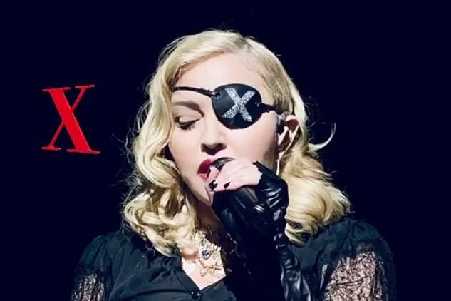 Мадонна во время своего выступления в Париже упала со стула: несмотря на травму колена, звезда свои концерты не отменила