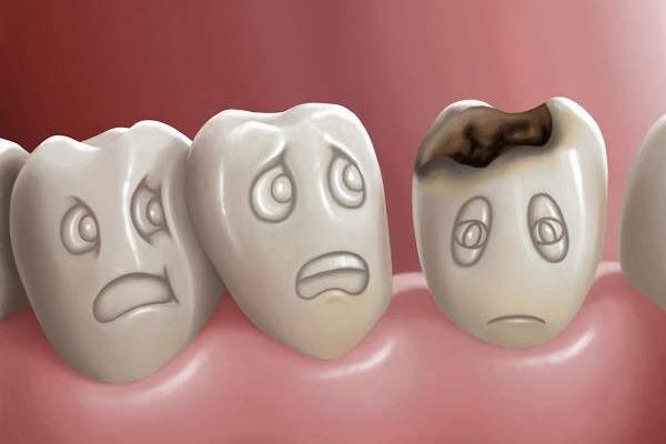 Проблемы с зубами повышают риск развития рака: MedicalXpress 