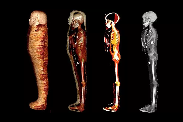 Раскрыты секреты 2300-летней мумии мальчика