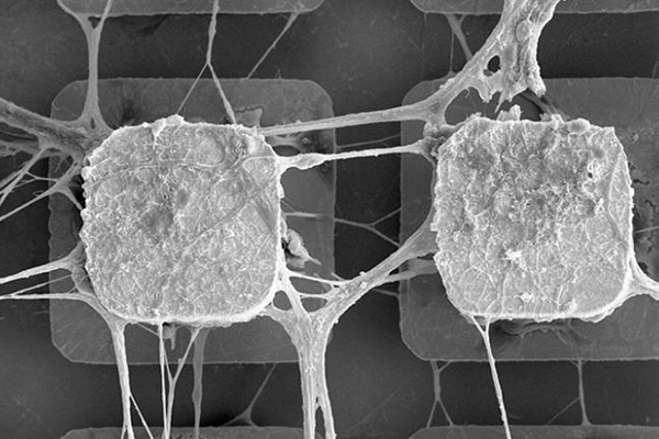 Исследователи вознамерились интегрировать стволовые клетки человеческого мозга в микрочипы 