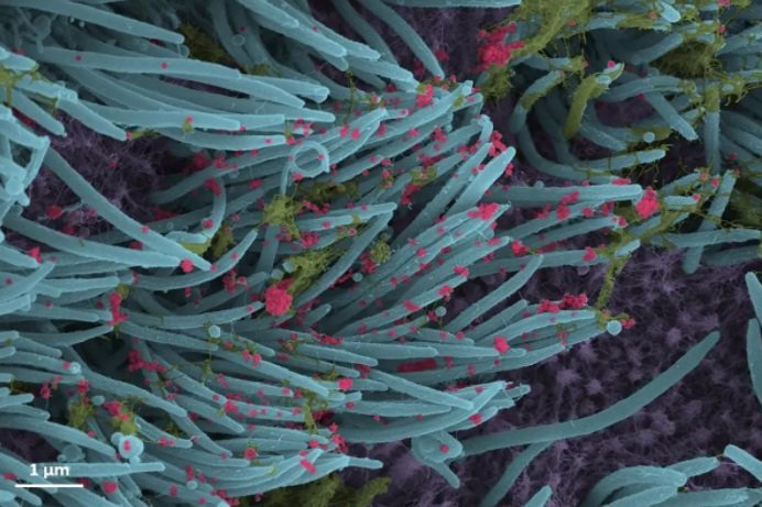 Как частицы вируса SARS-CoV-2 поражают легкие человека: ученые получили изображения с высоким разрешением