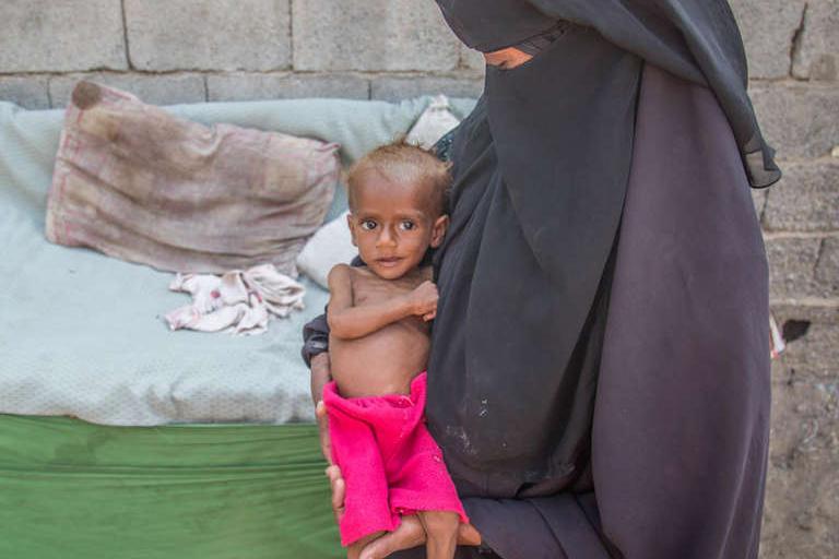 В Йемене около 85 000 детей, возможно, умерли от голода