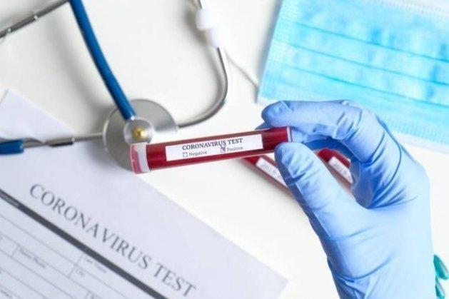 В Армении не успевают госпитализировать больных коронавирусом: За сутки выявлено 697 случаев