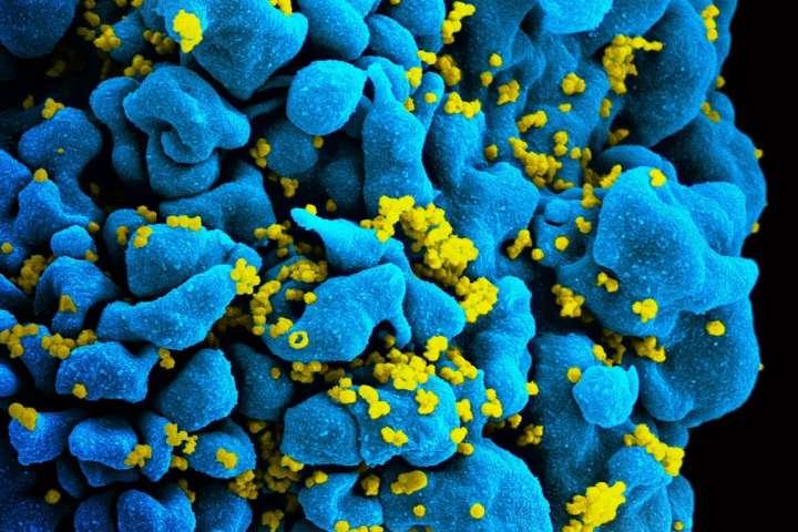 Новый белок для уничтожения вирусов покончит с ВИЧ навсегда? 