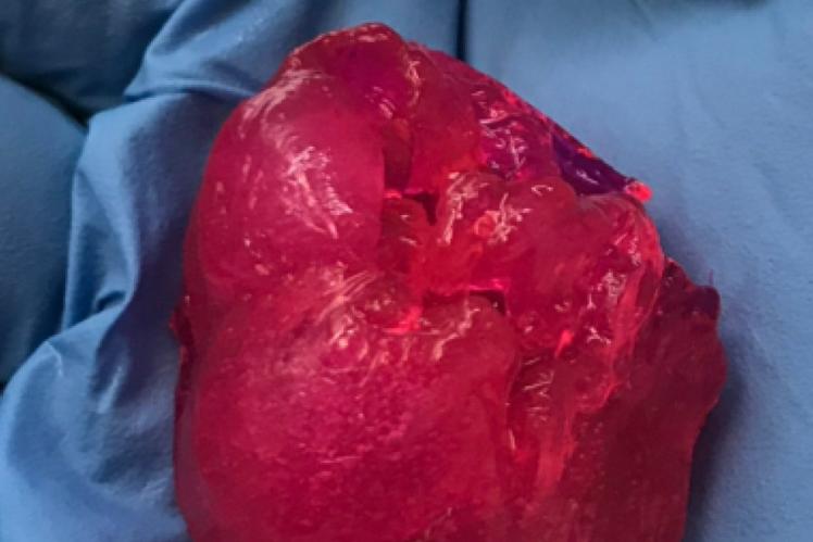 Разработана технология, позволяющая печатать органы из клеток крови: уже создано работающее мини-сердце