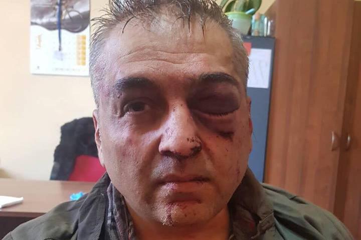 Подробности нападения на HSBC в Ереване: Преступник был вооружен гранатой и ружьем
