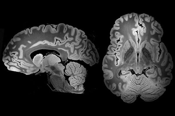 Специалисты впервые смогли получить самое детальное изображение человеческого мозга