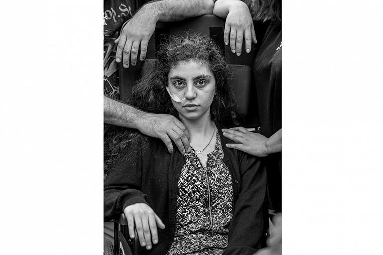 Армянская девочка, вышедшая из кататонии и другие важные события: опубликован список номинантов на премию World Press Photo