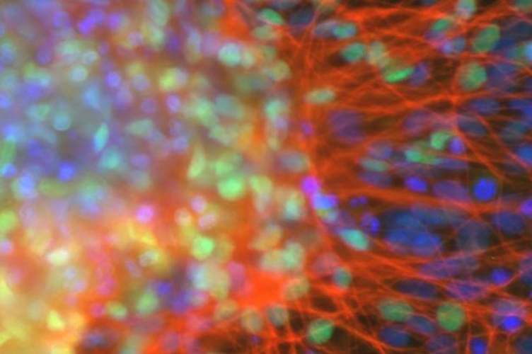 Медицина будущего: открыт механизм преобразования стволовых клеток в органы