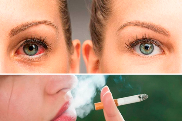 Курение удваивает риск стать жертвой дегенерации сетчатки глаза: новое исследование 